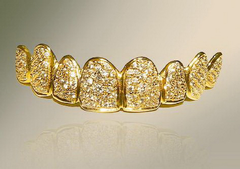 Des dents en diamants les plus chers du monde