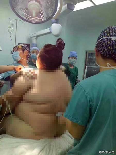 16 membres du personnel médical aident une femme de 140 kg à accoucher