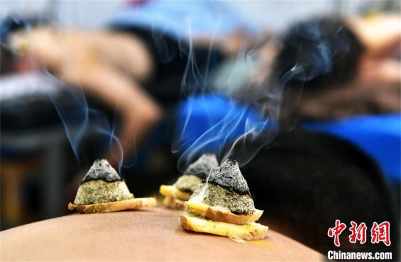 Les experts avertissent : la moxibustion Sanfu ne convient pas à tout le monde