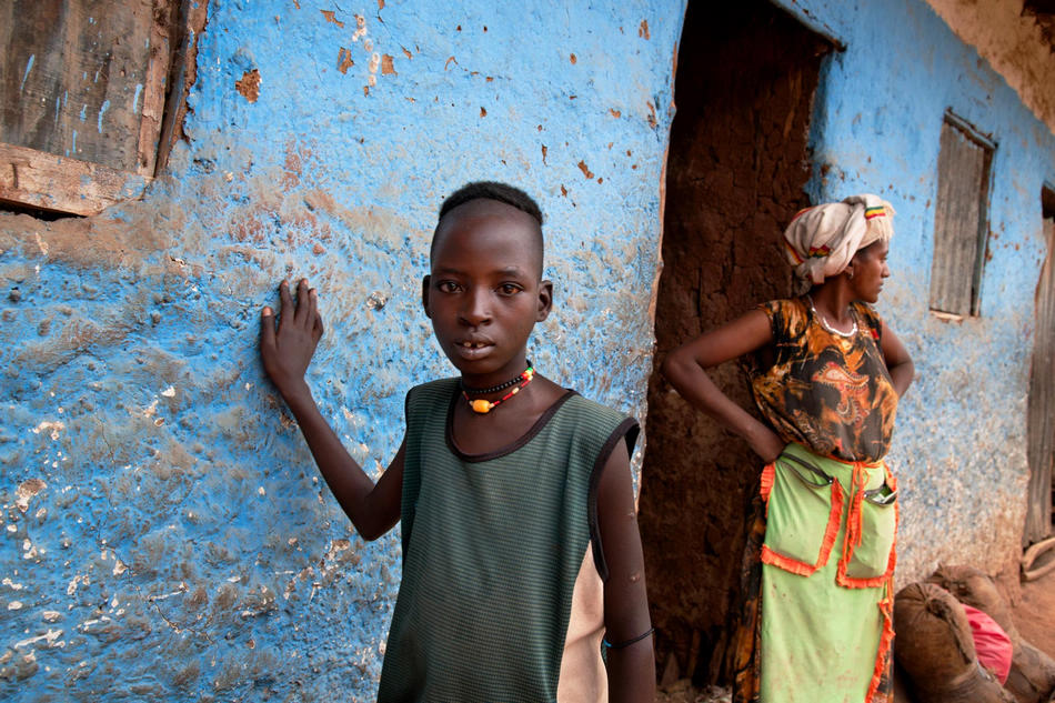 Misérable ! Les enfants maudits impitoyablement tués en Ethiopie (9)