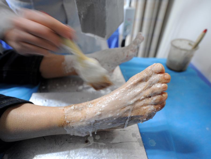 Une femme pendant une séance de traitement à la cire, à la Faculté de Médecine Traditionnelle Chinoise du Shanxi à Taiyuan, capitale de la Province du Shanxi, dans le Nord de la Chine, dans le Nord de la Chine, le 23 novembre 2012..