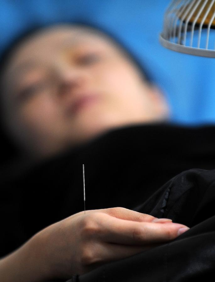 Une femme pendant une séance d'acupuncture à Taiyuan, capitale de la Province du Shanxi, dans le Nord de la Chine, le 23 novembre 2012.