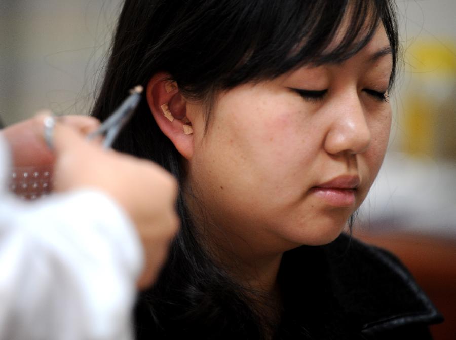 Une jeune fille applique de la pâte de plantes sur ses oreilles, à l'hôpital affilié à la Faculté de Médecine Traditionnelle Chinoise du Shanxi à Taiyuan, capitale de la Province du Shanxi, dans le Nord de la Chine, le 23 novembre 2012.