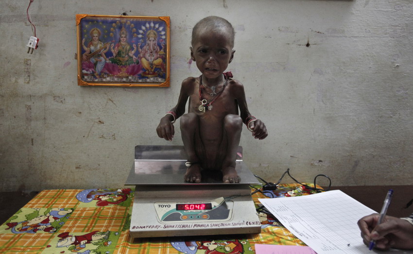 Le 1er février 2012 dans le district de Shivpuri de l'Etat central Madhya Pradesh, un employé d'un centre de rétablissement nutritionnel pèse une petite fille qui souffre d'une grave malnutrition. REUTERS/Adnan