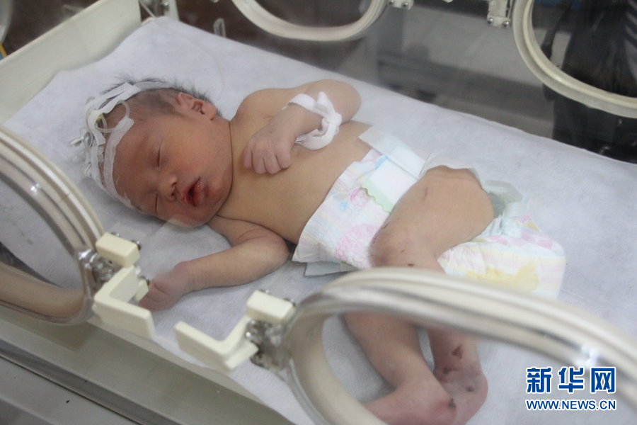 Chine: un nouveau-né sauvé d'un conduit de toilettes (11)