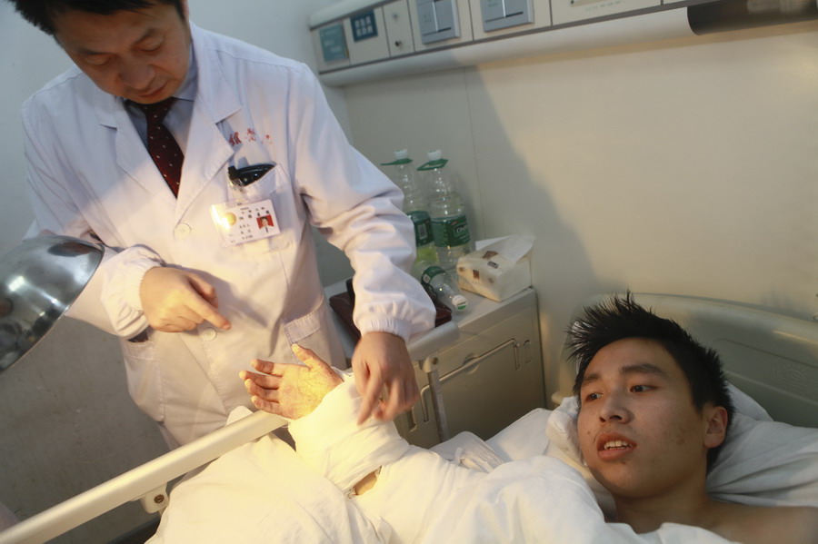 Un médecin vérifie la main droite de Xiao Wei après une chirurgie de rattachement à l'hôpital Xiangya à Changsha, province du Hunan, le 10 Décembre 2013 (document fourni par l'hôpital Xiangya, Central South University).